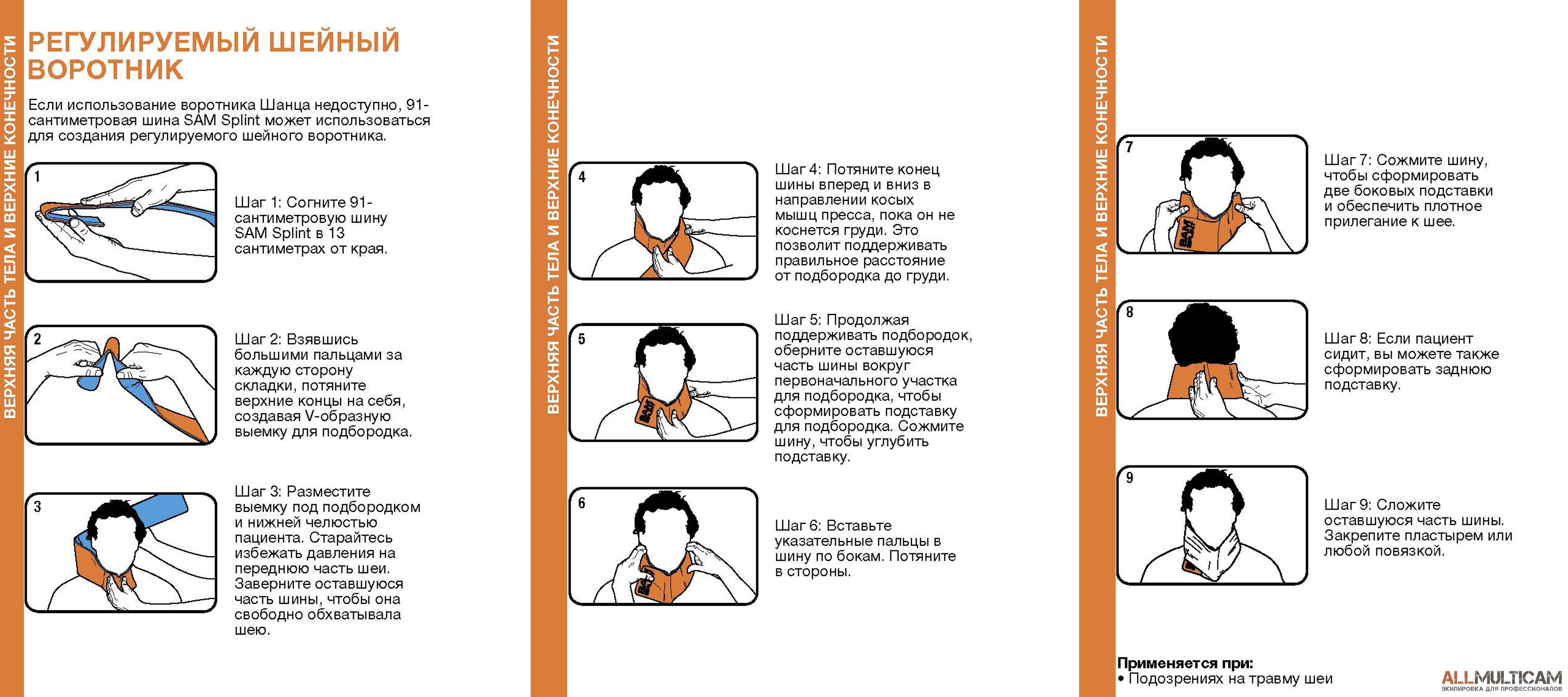 Как правильно подобрать воротник шанца. Шина Sam Splint. Наложение воротника Шанца алгоритм. Схема ношения воротника Шанца. Наложение шейного воротника Шанца.