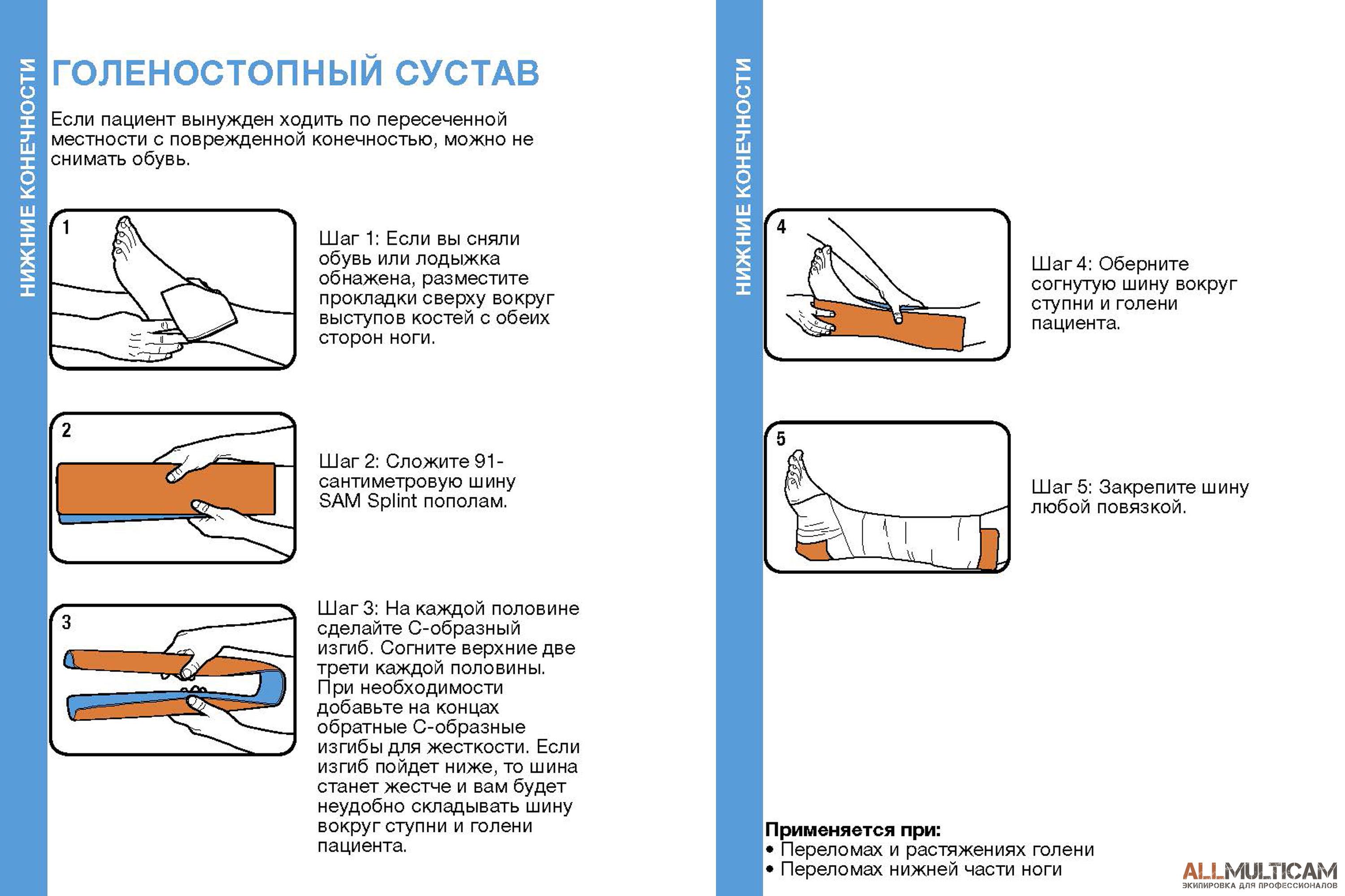 Схема наложения лечебных прокладок