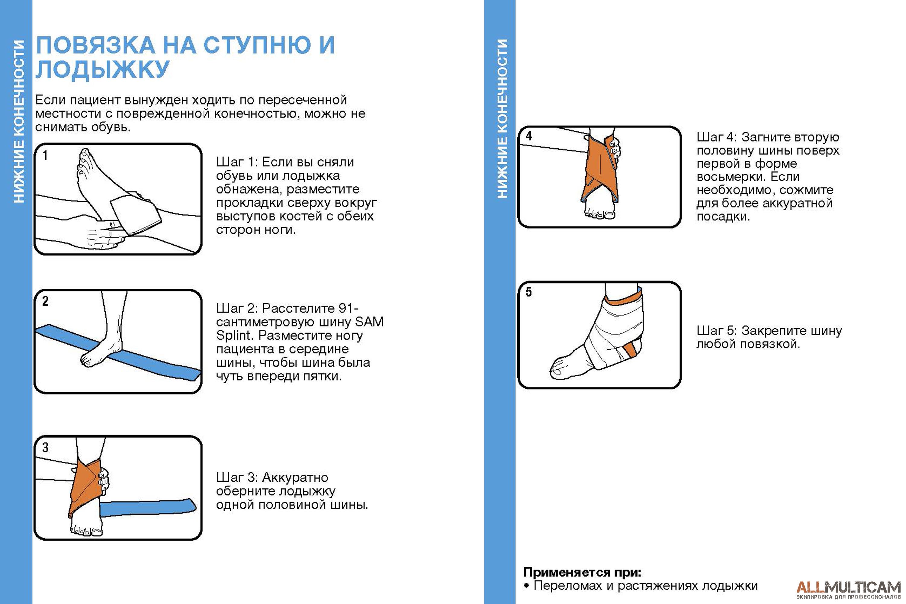 Как наложить обувь