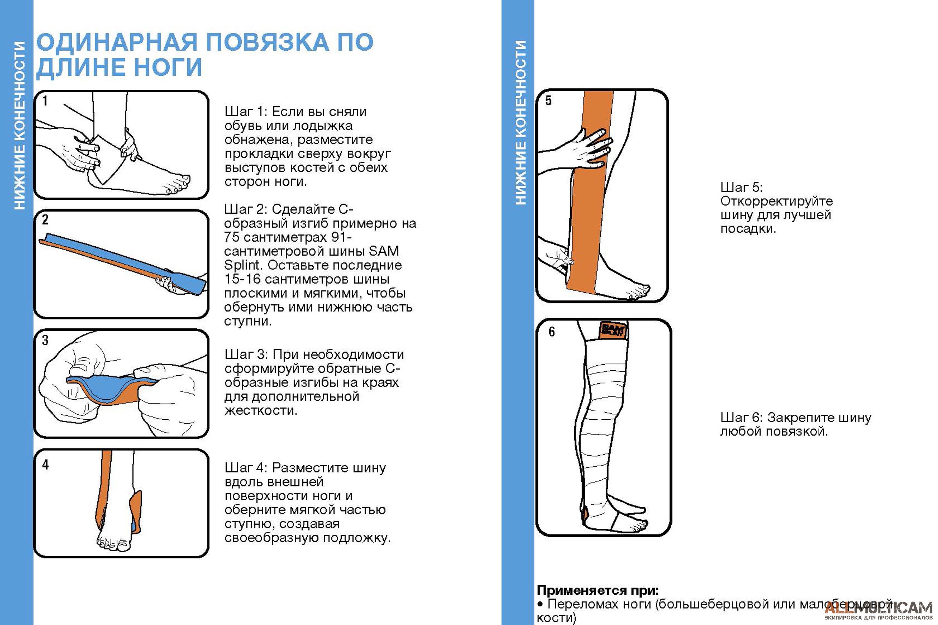 Одинарная повязка по длине ноги