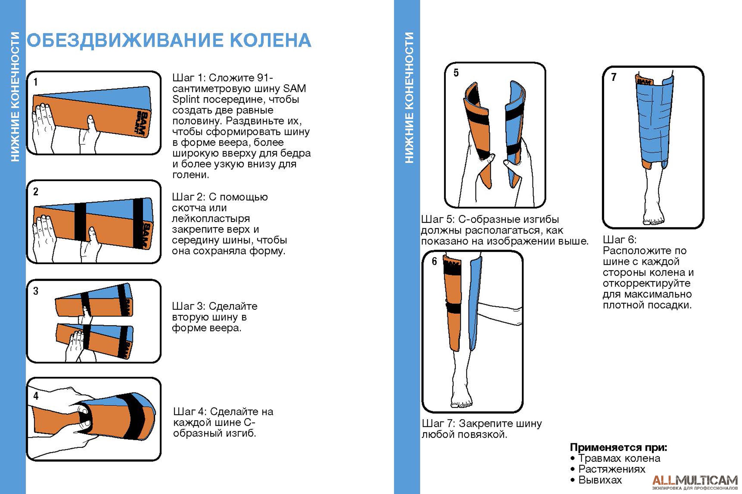 Обездвиживание колена