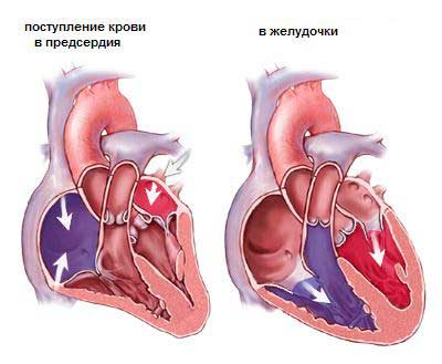 порок_сердца.jpg