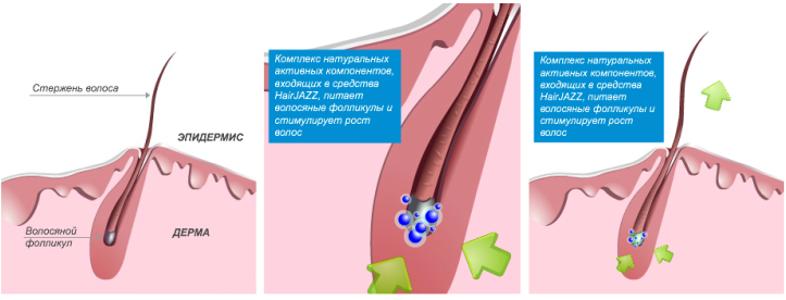 HairJAZZ_hair_jazz_derma_123_new.png