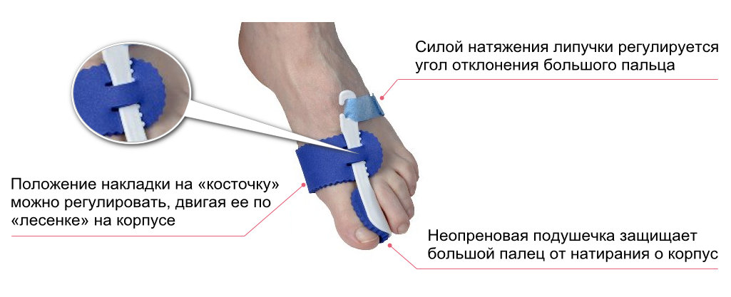 Ушиб пальцев стопы карта вызова