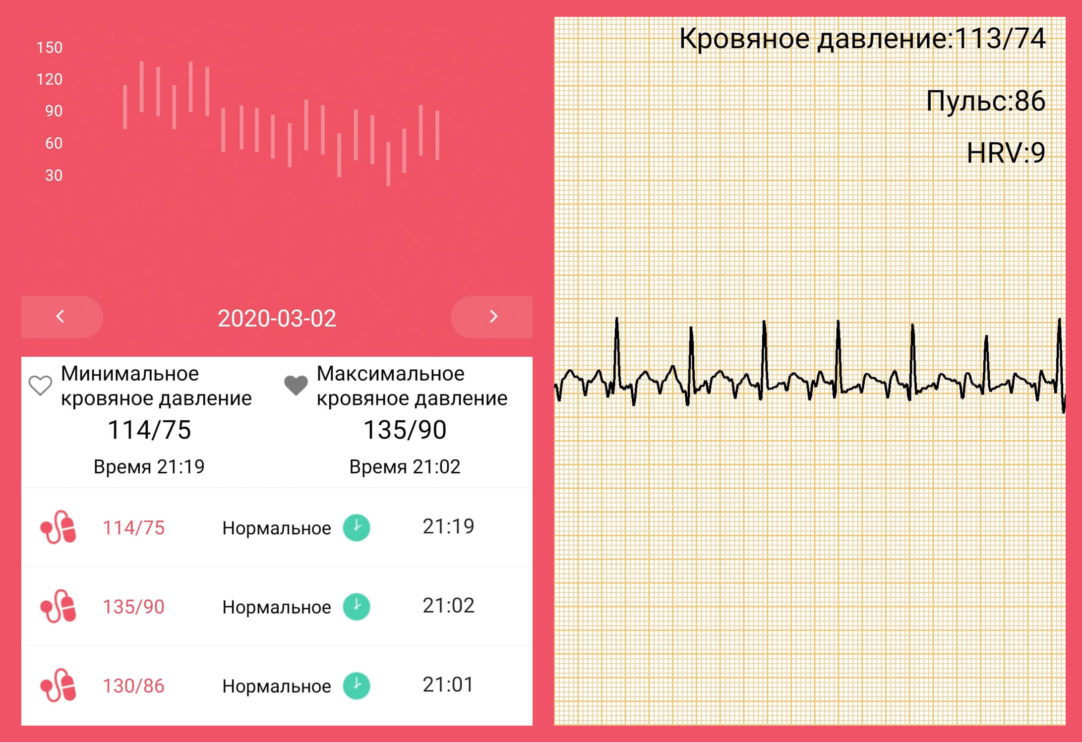 При измерении пульса человека определите частоту