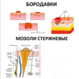 Вирга Стоп - Размягчающий флюид для стержневых мозолей от Golden Trace