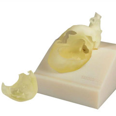 Stratasys в клинических исследованиях в области детской кардиохирургии
