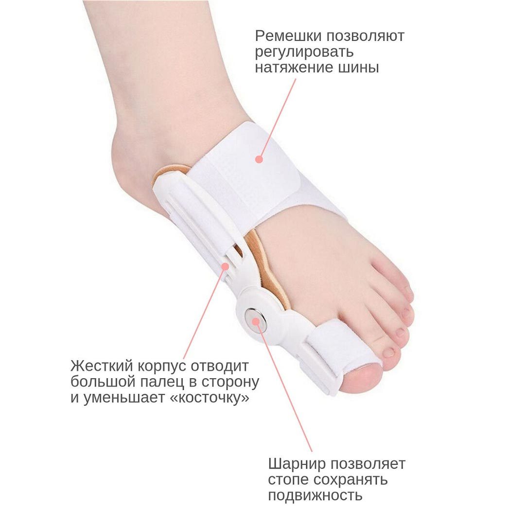 Фиксатор relax foot. Вальгусная шина goodnight bunion. Вальгусная шарнирная шина hallux valgus. Бандаж-шина bunion aid hinged splint for bunions корректор большого пальца. Вальгус шины.